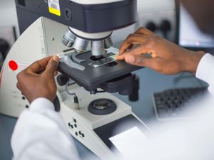 Supporting image for story: NHS to roll out ‘revolutionary’ blood test for lung cancer