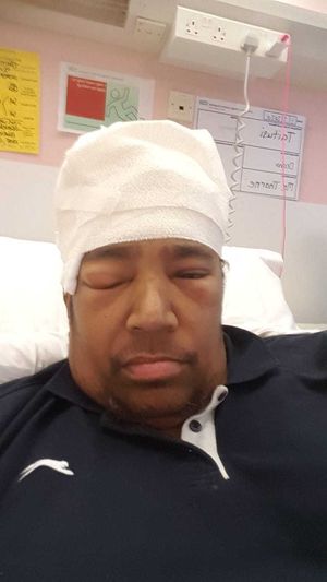 Taitusi the day after his surgery