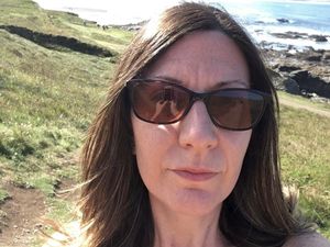 Supporting image for story: Wolverhampton woman undergoing cancer treatment warns signs to look out for