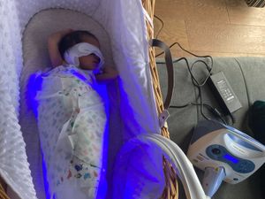 Supporting image for story: Treatment of newborns with jaundice is a first for hospital