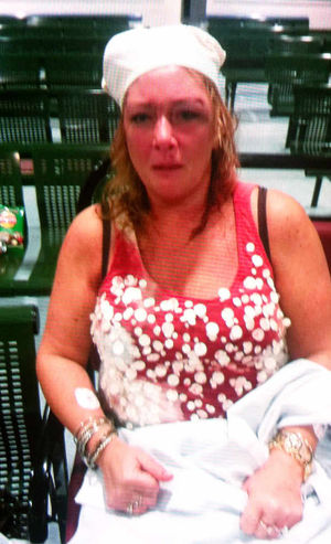 Mother Lorraine after the attack