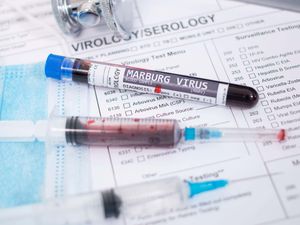 Supporting image for story: Rwanda and WHO declare end of Marburg outbreak after no new cases reported