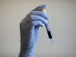 Supporting image for story