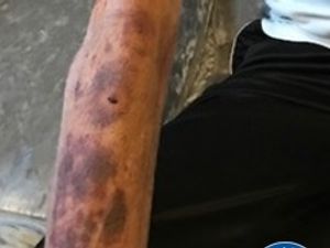 Supporting image for story: Robbers leave grandfather battered and bruised in early-hours raid