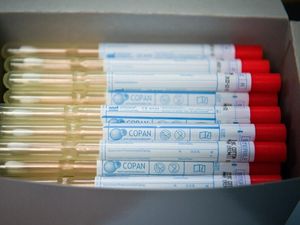 Supporting image for story: Men’s blood ‘contains higher levels of protein that helps Covid-19 infect cells’