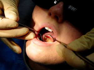 Supporting image for story: NHS dental patients told to ‘pay private fees’ if they want treatment