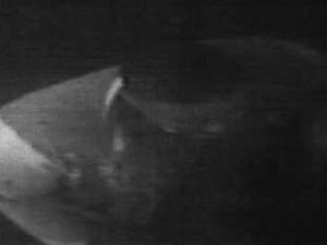 Supporting image for story: Bodybuilder left teen needing 40 stitches after attack outside Walsall takeaway