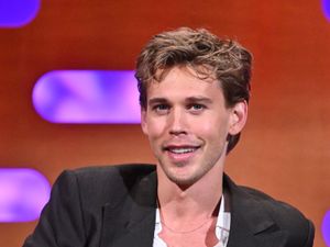 Supporting image for story: Austin Butler says he ‘probably damaged’ vocal cords playing Elvis role