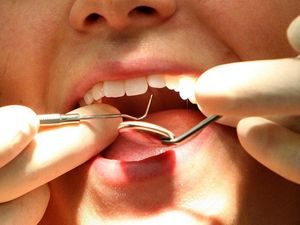 Supporting image for story: Could bioengineered teeth spell the end of dreaded fillings and costly implants?