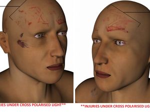 Supporting image for story: Bootlace marks proved Dalian Atkinson was kicked at least twice in the head