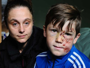 Supporting image for story: Facebook hit-and-run appeal goes viral: You won't get away with this, vows injured boy's mum