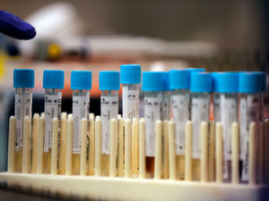 Supporting image for story: Black Country and Staffordshire authorities among first to start community testing programmes