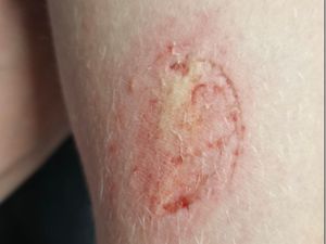 Supporting image for story: 'Like something out of The Walking Dead': Call for tougher action on thugs who bite and spit at police