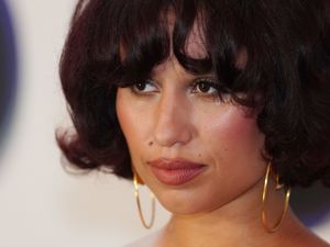 Supporting image for story: Raye postpones tour after medical assessment: ‘This decision burns me to make’