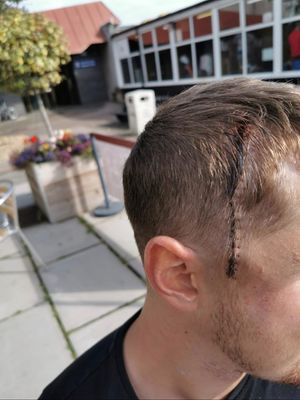 Scott Hinch after surgery