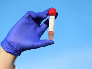 Supporting image for story: Covid infections ‘will fall slowly even if R remains below 1 till mid-February’