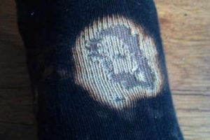 Supporting image for story: Oswestry man finds face of Jesus on sock