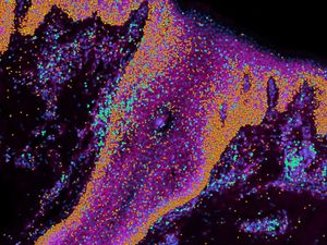 Supporting image for story: Human skin map gives ‘recipe’ to build skin and ‘could help prevent scarring’