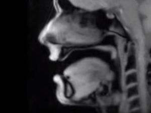 Supporting image for story: Unnerving MRI clip shows how your mouth moves when you talk