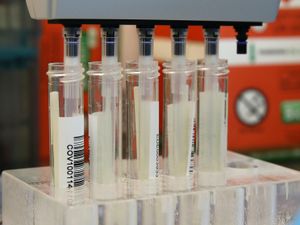 Supporting image for story: Four more coronavirus deaths in Shropshire and two in Powys  