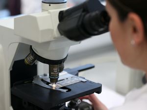 Supporting image for story: Lung cancer in non-smokers ‘biologically distinct’ from that in smokers – study