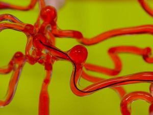 Supporting image for story: Worm-like robotic thread could improve clot-reducing treatments