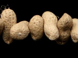 Supporting image for story: Greater focus on allergy prevention by NHS needed to protect children – MP