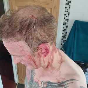 Tomos Ryan was left covered in blood after the bird's attack