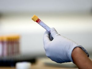 Supporting image for story: One further coronavirus death in Powys – but none in Shropshire