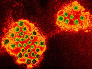 Supporting image for story: Diamond wedding is hit by Norovirus bug