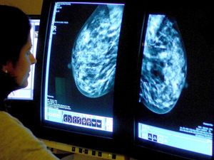 Supporting image for story: Breast screening bus may be withdrawn from Shropshire town
