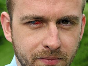 Supporting image for story: My fight for sight: Why Star reporter Nick will never wear contact lenses again