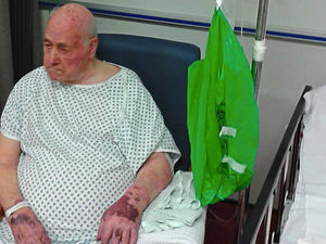 Supporting image for story: Patient, 95, given plastic bag for sling at Wolverhampton's New Cross Hospital
