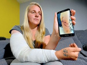 Supporting image for story: 'The flesh was coming out of my arm': Dog attack victim left needing four-hour operation