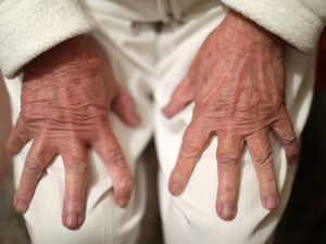 Supporting image for story: Heart health could be biggest risk factor for future dementia rates – study