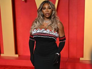 Supporting image for story: Serena Williams has cyst ‘the size of a small grapefruit’ removed from her neck