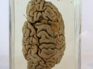 Supporting image for story: Brains of young people with severe behavioural problems are ‘wired differently’