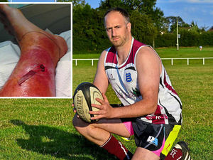 Supporting image for story: Dog poo on pitch almost cost rugby player his foot