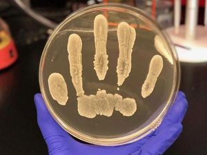 Supporting image for story: Scientists have found a cancer-fighting chemical in human skin bacteria