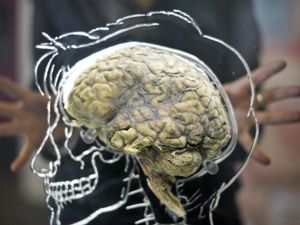 Supporting image for story: Increase in rare brain inflammation linked to Covid-19, scientists say