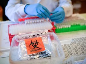 Supporting image for story: Shropshire's Green Party calls for more NHS funding and coronavirus tests