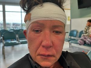 Supporting image for story: 'I was covered in blood': Woman lifts lid on violent incident that left her with head wound