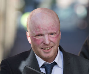 Pearson was badly injured and in a coma in the blaze