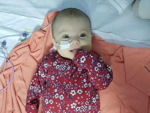 Supporting image for story: Telford couple share daughter's battle with rare liver condition to raise awareness on 'Big Yellow Friday'