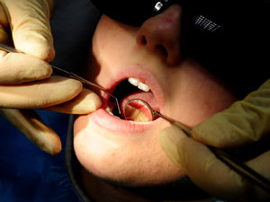 Supporting image for story: Dental association warns access has 'fallen off a cliff' during pandemic