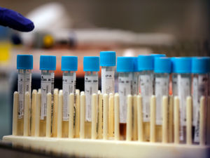 Supporting image for story: Eleven more coronavirus hospital deaths in the Black Country, Staffordshire and Birmingham