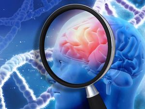 Supporting image for story: Could a simple eye test detect the early signs of a rare form of dementia?