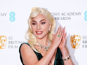 Supporting image for story: Man who shot Lady Gaga’s dog walker jailed for ‘cold-hearted, violent attack’