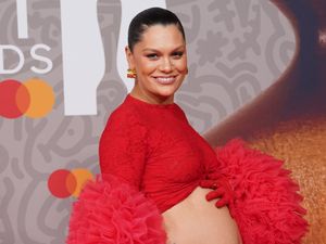 Supporting image for story: Jessie J reveals diagnosis with OCD and ADHD