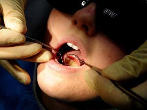 Supporting image for story: Fines leading to drop in Shropshire dental treatments